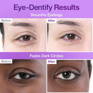 Numbuzin anti-aging eye care patches with NAD+ UAE