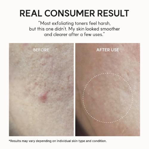 Arencia Eraser Shot Glycolic Acid Exfoliator