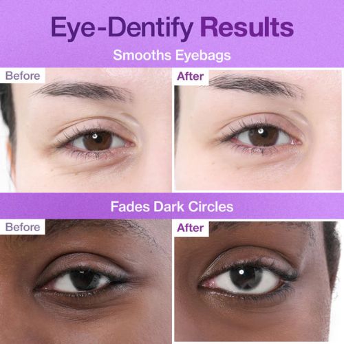 Numbuzin anti-aging eye care patches with NAD+ UAE