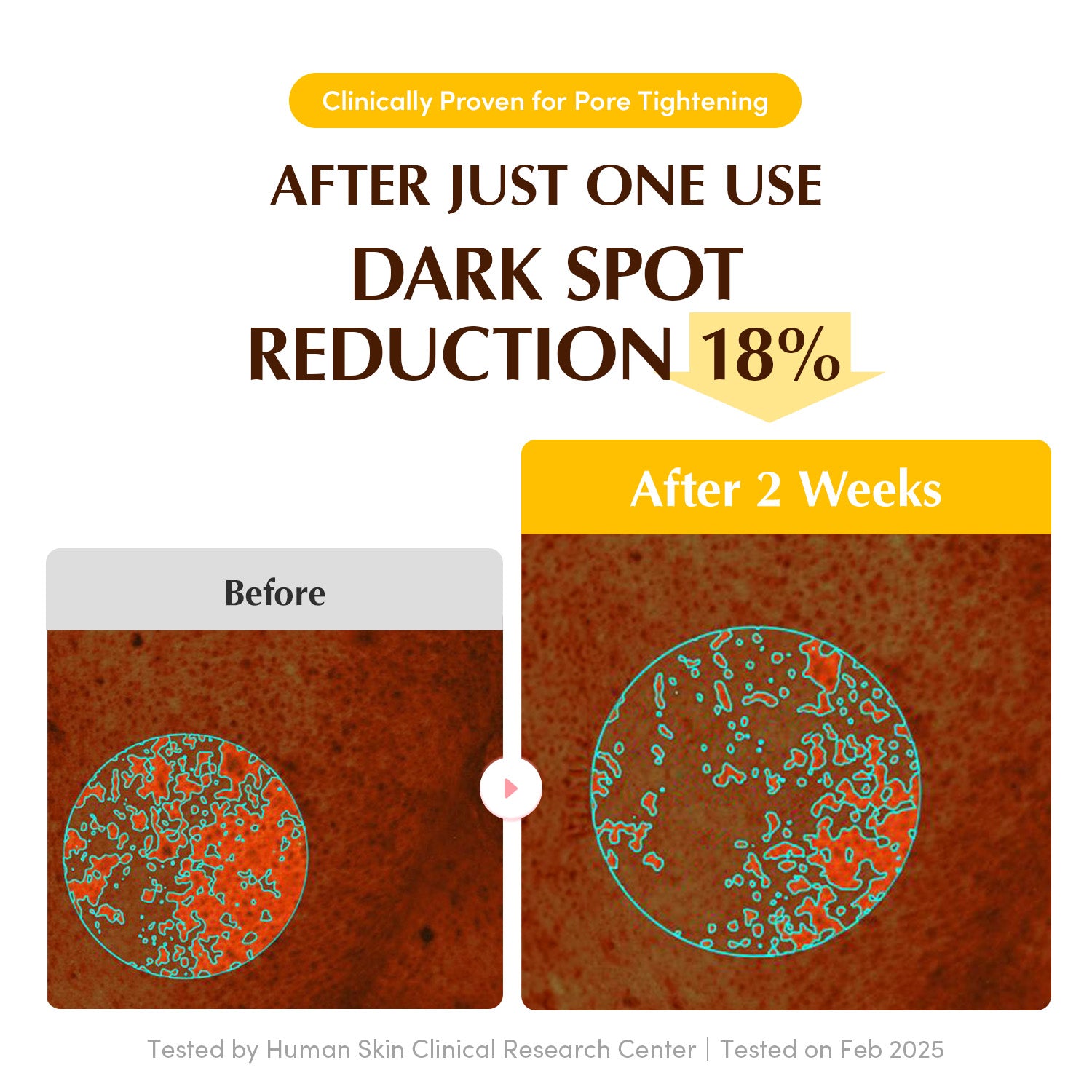 EQQUALBERRY Collagen Glow Up Hydrogel Mask – Korean Brightening Mask in Dubai
Niacinamide & Glutathione Hydrogel Mask – Deep Hydration & Glow
EQQUALBERRY Hydrogel Sheet Mask – Korean Skincare for Radiant Skin
Glutathione Collagen Mask for Dark Spots – EQQUALBERRY UAE
